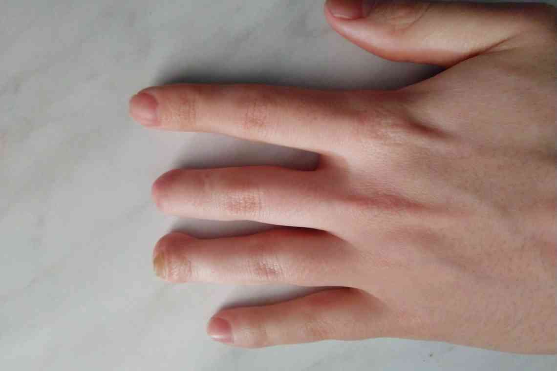 Гігрома на пальці руки: як виявити і вилікувати?