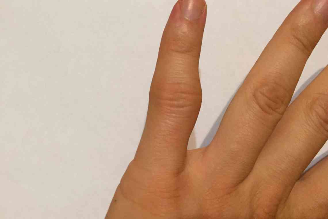 Побутові травми у дітей: що зробити, якщо малюк прищемив палець?