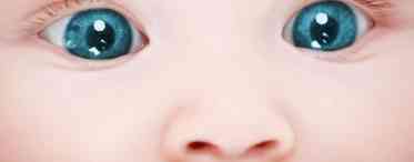 Закисання очей у новонароджених