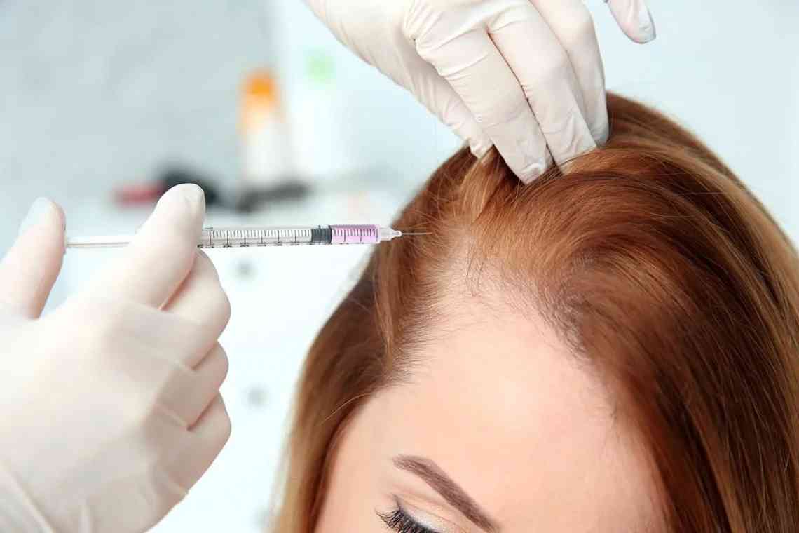 Мезотерапія - мікроін'єкції для волосся