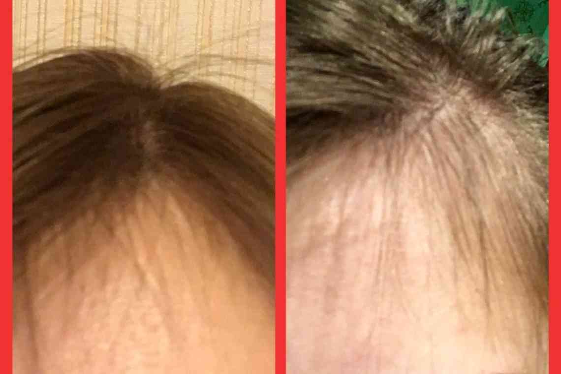Зміцнення коренів волосся від випадання