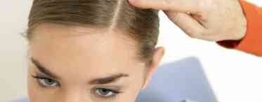 У чому особливість пілінгу шкіри голови в домашніх умовах?