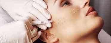 Біоармування обличчя гіалуроновою кислотою: користь і шкода