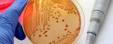 Дослідження мікрофлори зіву - точний метод діагностики інфекцій