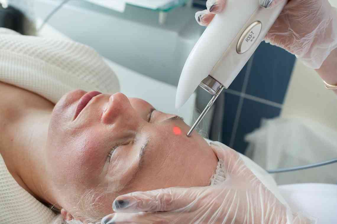 Лазерна наноперфорація обличчя: що це таке, особливості процедури