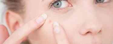 Які таблетки допоможуть позбутися прищів на обличчі?
