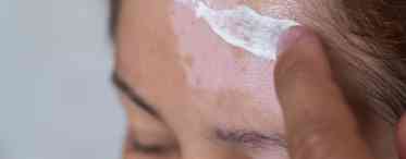 Порушення пігментації шкіри - білі плями