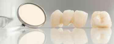 Чим обумовлена популярність імплантів з діоксиду цирконію в стоматології?