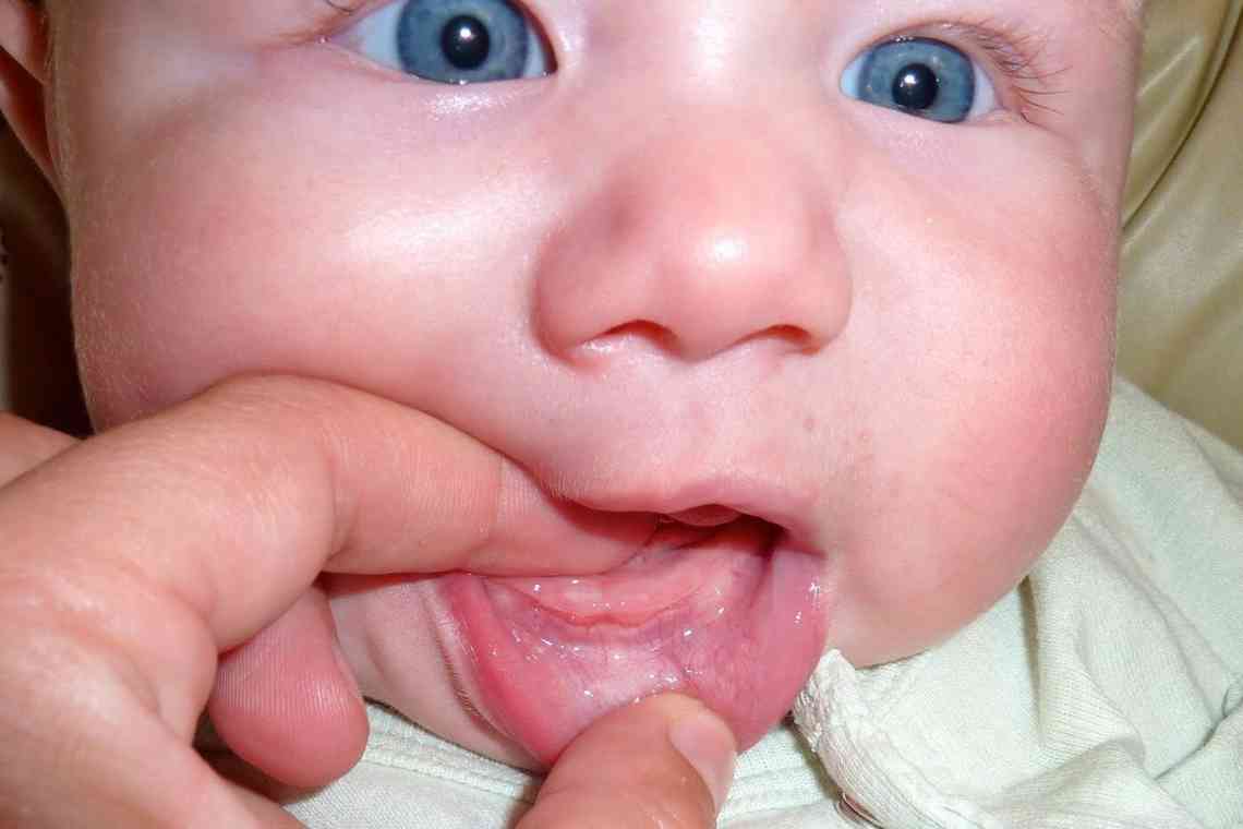 Чому виникає блювота при прорізуванні зубів у дітей?