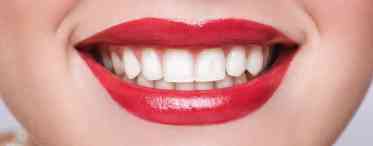 Як відновити емаль зубів і повернути собі красиву посмішку?