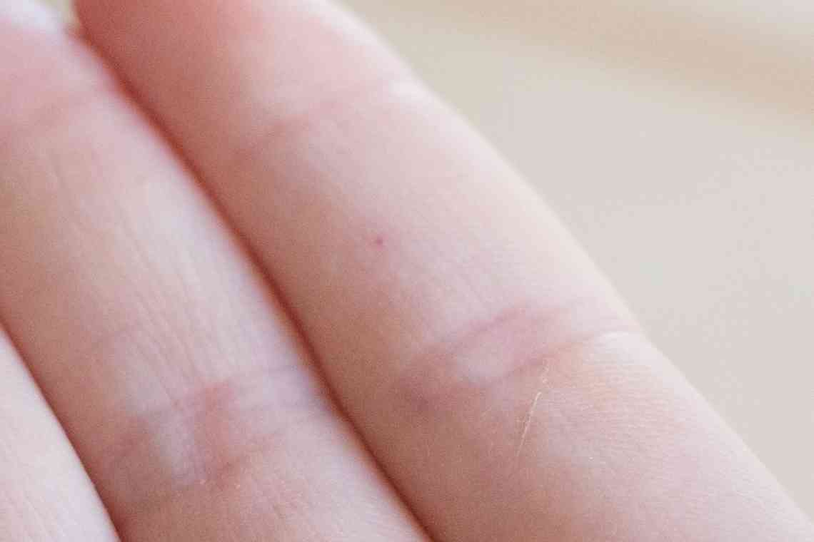 Чому з'являються червоні точки на руках і під шкірою?