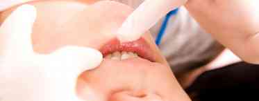 Як зміцнити десни при захворюваннях порожнини рота?