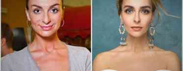 Навіщо Вікторія Берникова збільшила груди і зробила ринопластику? Фото до і після операції.
