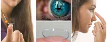 10 питань офтальмологу: про шкоду лінз, синці під очима від короткозорості і не тільки