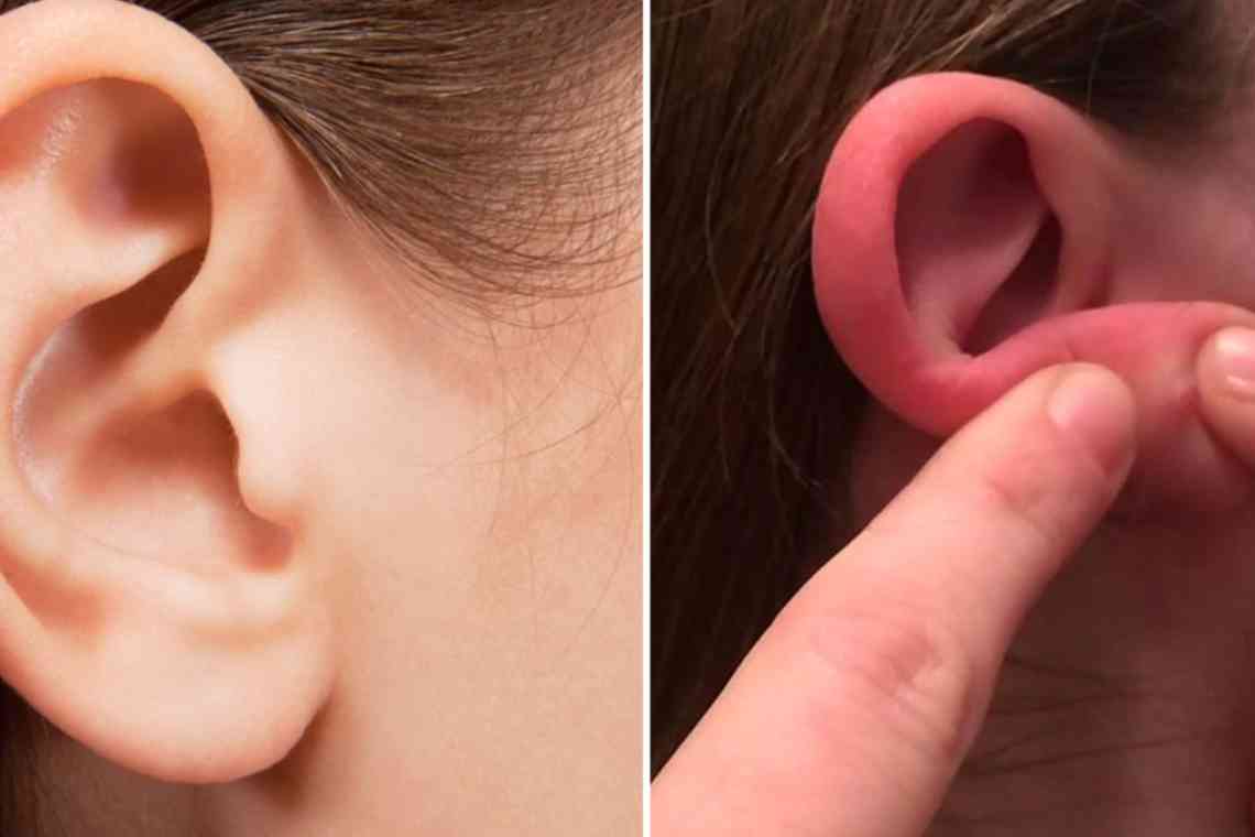 Прищ всередині і біля вуха: чому з'являється і як його лікувати