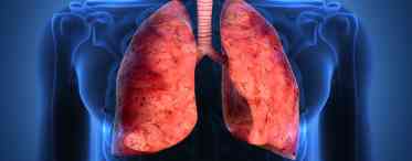 Інфільтративний туберкульоз легенів