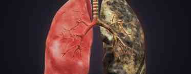 Пошкодження легенів