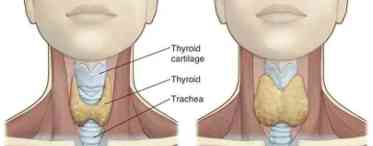 Функціональна автономія щитовидної залози