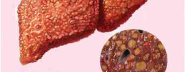 Пухлини печінки
