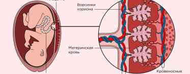 Порушення маточно-плацентарного кровотоку