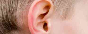 Екзема зовнішнього вуха