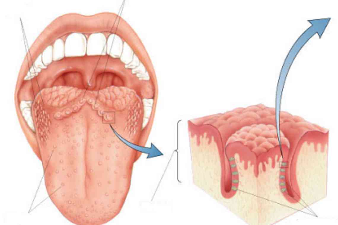 Доброякісні пухлини порожнини рота