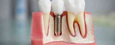 Сучасна стоматологічна клініка: ваш шлях до сяючої посмішки