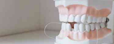 Выбор лучшего зубного протеза: что нужно знать