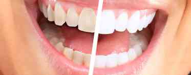 Шлях до здорових зубів і сліпучої посмішки